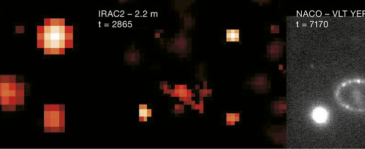 A Ring Around SN1987A